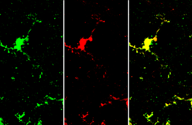 Anti-Iba1 antibody [HL22-RT] used in IHC (Frozen sections) (IHC-Fr). GTX635400