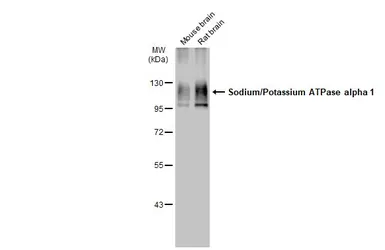 Anti-Sodium/Potassium ATPase alpha 1 antibody [HL114] used in Western Blot (WB). GTX635461