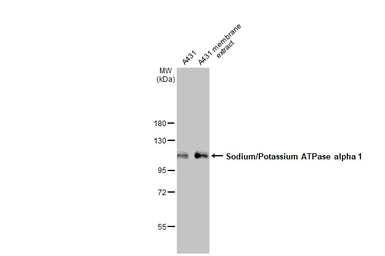 Anti-Sodium/Potassium ATPase alpha 1 antibody [HL114] used in Western Blot (WB). GTX635461
