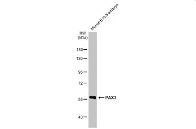 Anti-PAX3 antibody [HL160] used in Western Blot (WB). GTX635463