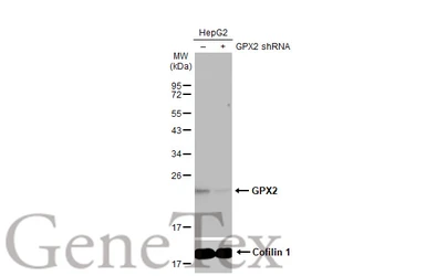Anti-GPX2 antibody [HL125] used in Western Blot (WB). GTX635477