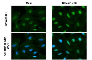 Anti-ATR (phospho Thr1989) antibody [HL132] used in Immunocytochemistry/ Immunofluorescence (ICC/IF). GTX635571