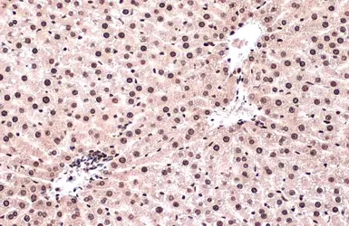 Anti-ATR (phospho Thr1989) antibody [HL132] used in IHC (Paraffin sections) (IHC-P). GTX635571