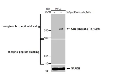 Anti-ATR (phospho Thr1989) antibody [HL132] used in Western Blot (WB). GTX635571