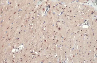 Anti-ATR (phospho Thr1989) antibody [HL132] used in IHC (Paraffin sections) (IHC-P). GTX635571