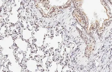 Anti-ATR (phospho Thr1989) antibody [HL132] used in IHC (Paraffin sections) (IHC-P). GTX635571