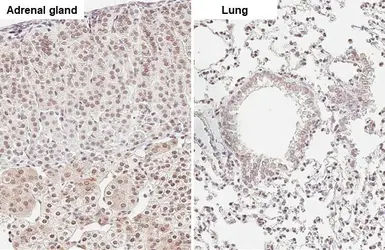 Anti-ATR (phospho Thr1989) antibody [HL132] used in IHC (Paraffin sections) (IHC-P). GTX635571