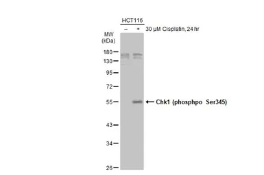 Anti-Chk1 (phospho Ser345) antibody [HL122] used in Western Blot (WB). GTX635572