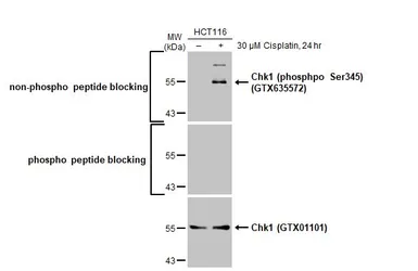 Anti-Chk1 (phospho Ser345) antibody [HL122] used in Western Blot (WB). GTX635572