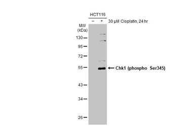 Anti-Chk1 (phospho Ser345) antibody [HL122] used in Western Blot (WB). GTX635572
