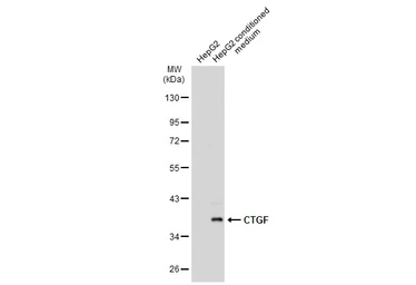 Anti-CTGF antibody [GT8610] used in Western Blot (WB). GTX635578