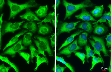 Anti-FACL4 antibody [HL229] used in Immunocytochemistry/ Immunofluorescence (ICC/IF). GTX635616