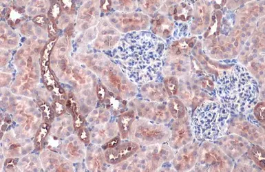 Anti-FACL4 antibody [HL229] used in IHC (Paraffin sections) (IHC-P). GTX635616