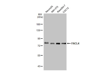 Anti-FACL4 antibody [HL229] used in Western Blot (WB). GTX635616