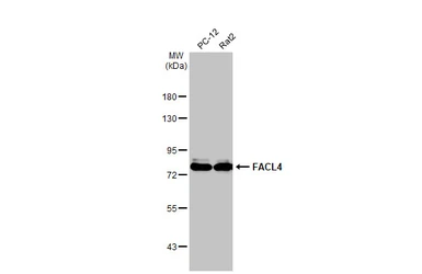 Anti-FACL4 antibody [HL229] used in Western Blot (WB). GTX635616