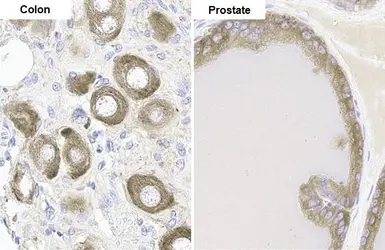 Anti-FACL4 antibody [HL229] used in IHC (Paraffin sections) (IHC-P). GTX635616
