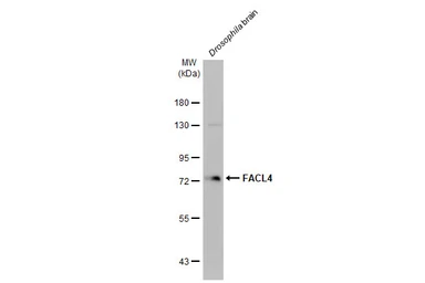 Anti-FACL4 antibody [HL229] used in Western Blot (WB). GTX635616