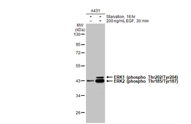 Anti-ERK1 (phospho Thr202/Tyr204) + ERK2 (phospho Thr185/Tyr187) antibody [HL173] used in Western Blot (WB). GTX635617