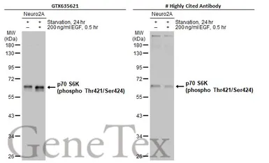 Anti-p70 S6K (phospho Thr421/Ser424) antibody [HL129] used in Western Blot (WB). GTX635621
