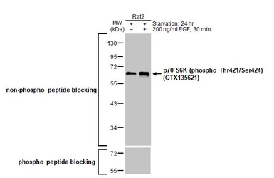 Anti-p70 S6K (phospho Thr421/Ser424) antibody [HL129] used in Western Blot (WB). GTX635621