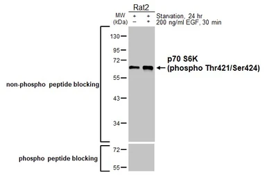 Anti-p70 S6K (phospho Thr421/Ser424) antibody [HL129] used in Western Blot (WB). GTX635621