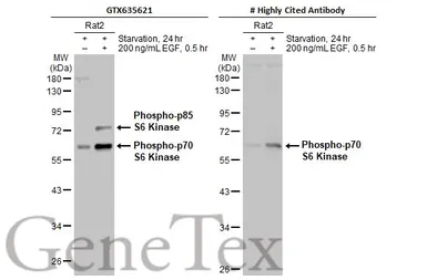 Anti-p70 S6K (phospho Thr421/Ser424) antibody [HL129] used in Western Blot (WB). GTX635621