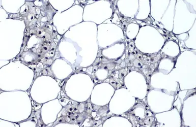 Anti-CDKN2A / p16INK4a antibody [GT1249] used in IHC (Paraffin sections) (IHC-P). GTX635638