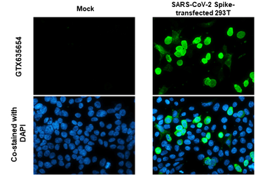Anti-SARS-CoV-2 (COVID-19) Spike S1 antibody [HL6] used in Immunocytochemistry/ Immunofluorescence (ICC/IF). GTX635654