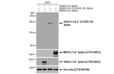 Anti-SARS-CoV-2 (COVID-19) Spike S1 antibody [HL6] used in Western Blot (WB). GTX635654