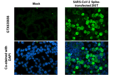Anti-SARS-CoV-2 (COVID-19) Spike S1 antibody [HL1 Anti-SARS-CoV-2 (COVID-19) Spike S1 antibody [HL1