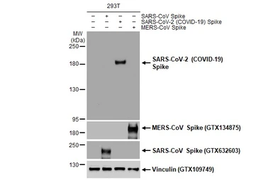 即納！最大半額！ Anti-SARS-CoV-2 [HL1 antibody S1 Spike (COVID-19) その他