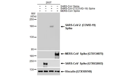 Anti-SARS-CoV-2 (COVID-19) Spike S1 antibody [HL263] used in Western Blot (WB). GTX635672