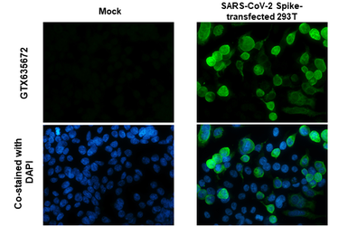 Anti-SARS-CoV-2 (COVID-19) Spike S1 antibody [HL263] used in Immunocytochemistry/ Immunofluorescence (ICC/IF). GTX635672