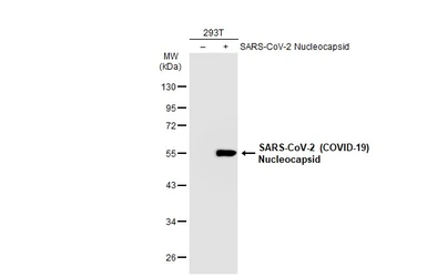 Anti-SARS-CoV-2 (COVID-19) Nucleocapsid antibody [HL249] used in Western Blot (WB). GTX635678