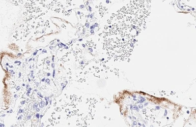 Anti-SARS-CoV-2 (COVID-19) Nucleocapsid antibody [HL344] used in IHC (Paraffin sections) (IHC-P). GTX635679