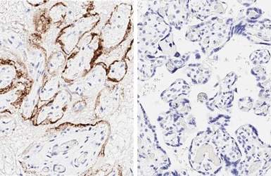 Anti-SARS-CoV-2 (COVID-19) Nucleocapsid antibody [HL344] used in IHC (Paraffin sections) (IHC-P). GTX635679