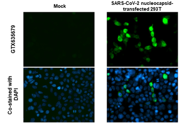 Anti-SARS-CoV-2 (COVID-19) Nucleocapsid antibody [HL344] used in Immunocytochemistry/ Immunofluorescence (ICC/IF). GTX635679