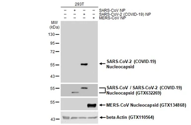 Anti-SARS-CoV-2 (COVID-19) Nucleocapsid antibody [HL344] used in Western Blot (WB). GTX635679