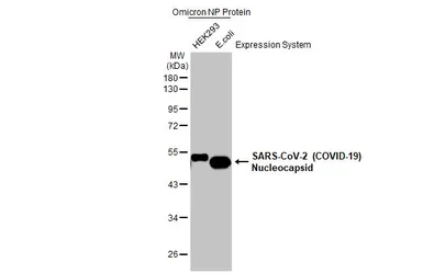 Anti-SARS-CoV-2 (COVID-19) Nucleocapsid antibody [HL344] used in Western Blot (WB). GTX635679