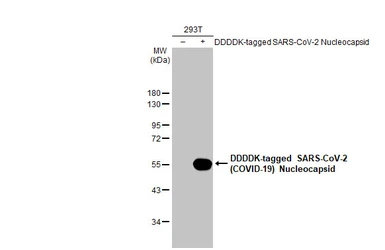 Anti-SARS-CoV-2 (COVID-19) Nucleocapsid antibody [HL344] used in Western Blot (WB). GTX635679