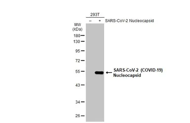 Anti-SARS-CoV-2 (COVID-19) Nucleocapsid antibody [HL146] used in Western Blot (WB). GTX635680