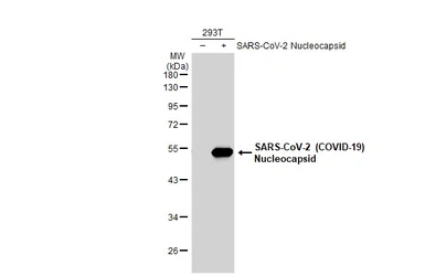 Anti-SARS-CoV-2 (COVID-19) Nucleocapsid antibody [HL5410] used in Western Blot (WB). GTX635685