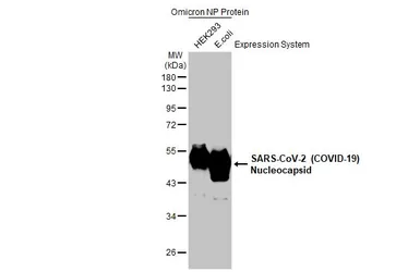 Anti-SARS-CoV-2 (COVID-19) Nucleocapsid antibody [HL5410] used in Western Blot (WB). GTX635685
