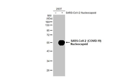 Anti-SARS-CoV-2 (COVID-19) Nucleocapsid antibody [HL5410] used in Western Blot (WB). GTX635685