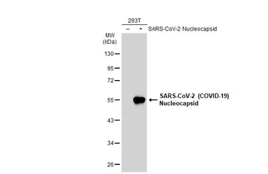 Anti-SARS-CoV-2 (COVID-19) Nucleocapsid antibody [HL448] (HRP) used in Western Blot (WB). GTX635686-01