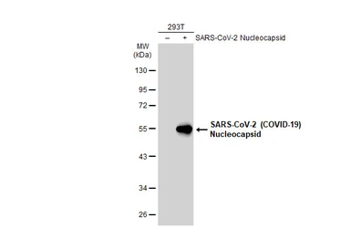 Anti-SARS-CoV-2 (COVID-19) Nucleocapsid antibody [HL448] (HRP) used in Western Blot (WB). GTX635686-01