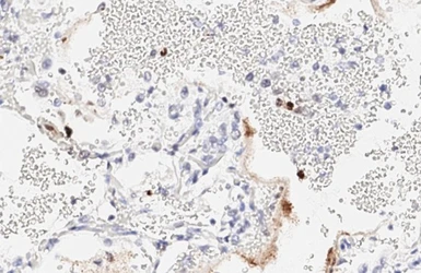 Anti-SARS-CoV-2 (COVID-19) Nucleocapsid antibody [HL448] used in IHC (Paraffin sections) (IHC-P). GTX635686