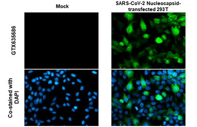 Anti-SARS-CoV-2 (COVID-19) Nucleocapsid antibody [HL448] used in Immunocytochemistry/ Immunofluorescence (ICC/IF). GTX635686