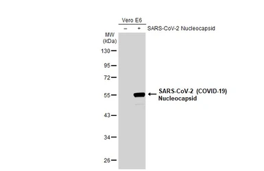 Anti-SARS-CoV-2 (COVID-19) Nucleocapsid antibody [HL448] used in Western Blot (WB). GTX635686