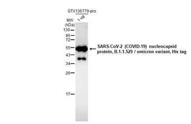 Anti-SARS-CoV-2 (COVID-19) Nucleocapsid antibody [HL448] used in Western Blot (WB). GTX635686